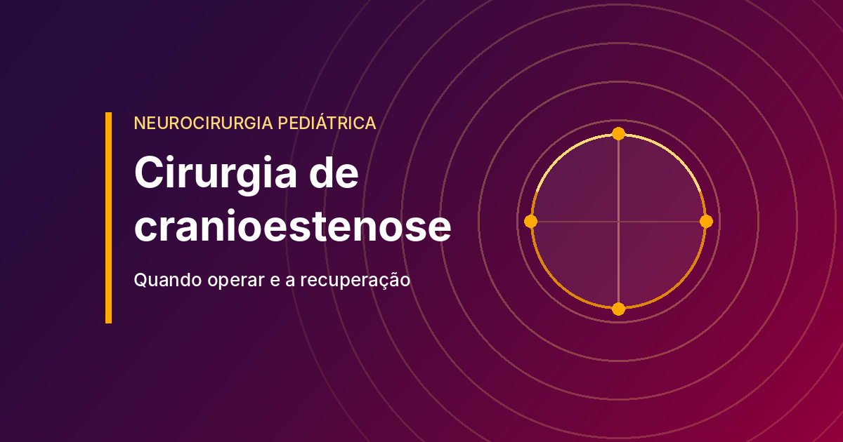 Cirurgia de cranioestenose: quando operar e como é a recuperação